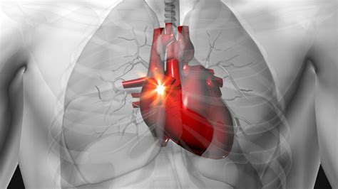 Possible Causes of Heart Racing at Night and Treating Options | New Health Advisor