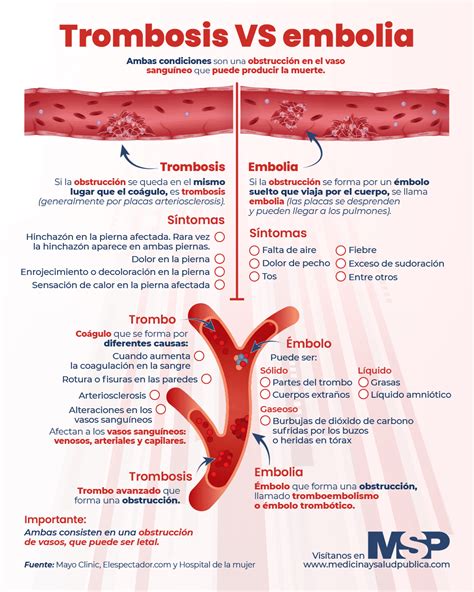 Diferencia entre Trombo Y Coagulo - Encuentra La Diferencia