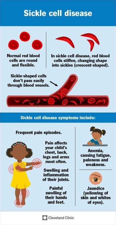 Sickle Cell Awareness Month Ep.1