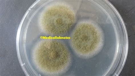 Aspergillus fumigatus: Introduction, Morphology, Pathogenicity, Lab