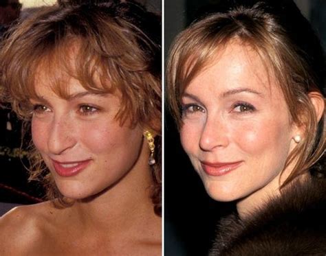 51 Most Popular Celebrity Nose Jobs: Before And After With Images | Fabbon