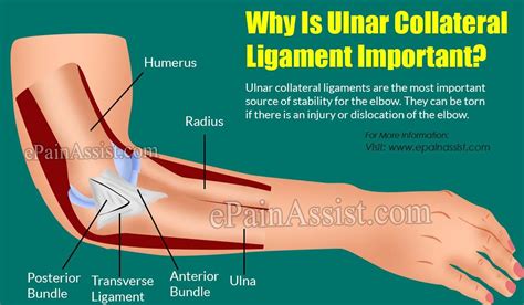 How Is Tommy John Surgery Done & What Is Its Recovery Period? Read:- https://www.epainassist.com ...