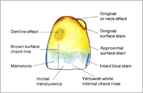 Special Effects in Dental Porcelain Types of Special Effect | Pocket ...