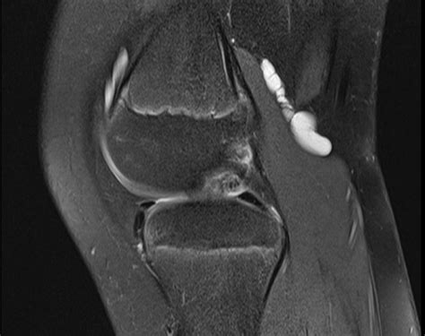 GP Referred Archives - MRI at Melbourne Radiology Clinic