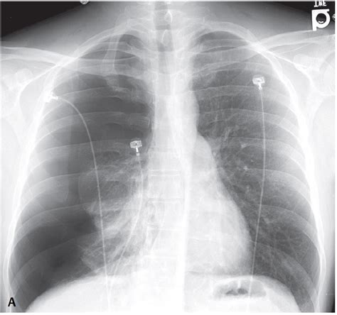 Manual Of Medicine on Twitter: "37-year-old man presents to the emergency department with ...