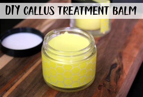 Homemade Callus Treatment Balm Recipe for Less Funky Feet