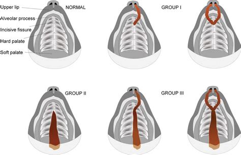 Cleft Lip and Palate in the Dog: Medical and Genetic Aspects | IntechOpen