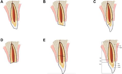 Dental Trauma and Alveolar Fractures | Plastic Surgery Key