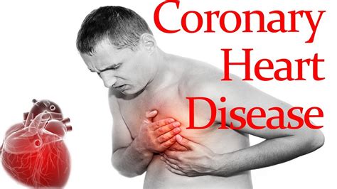 Coronary Heart Disease - Causes, Symptoms, Treatment