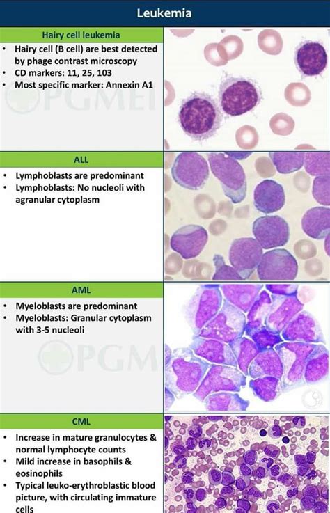 WBC disorders - MEDizzy