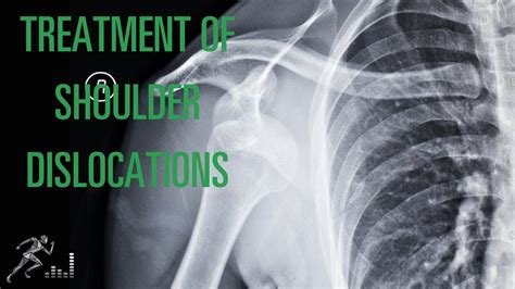 Shoulder Dislocation Types