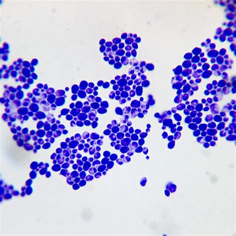 Candida albicans smear, Fungi prepared slides expert