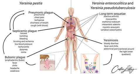 Pneumonic Plague Symptoms