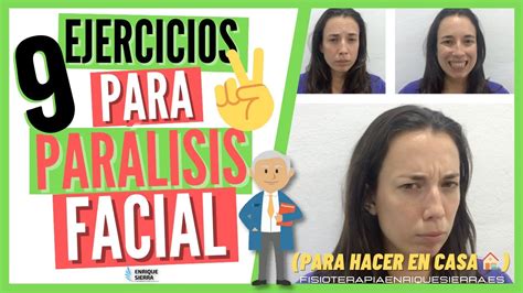 Qué Es La PARÁLISIS FACIAL? Y VÍDEO Con EJERCICIOS FisioStar | vlr.eng.br