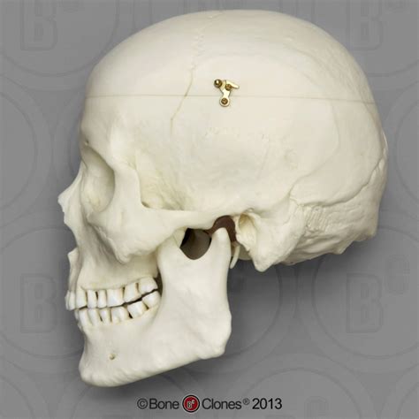 Bone Clones Human Male Asian Skull with Calvarium Cut (Replica) BC-092