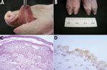 Clinical Manifestations of Senecavirus A Infection in Neonatal Pigs ...