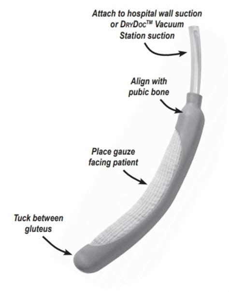 Cureus | Effect of a Female External Urinary Catheter on Incidence of Catheter-Associated ...