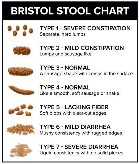 Does your stool look like these?