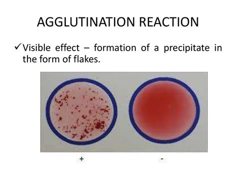 Antibody Agglutination