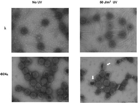 Electron micrographs of virions of bacteriophage λ (upper panels) and ...