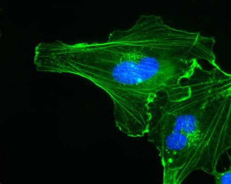 Space in Images - 2015 - 06 - Endothelial cells