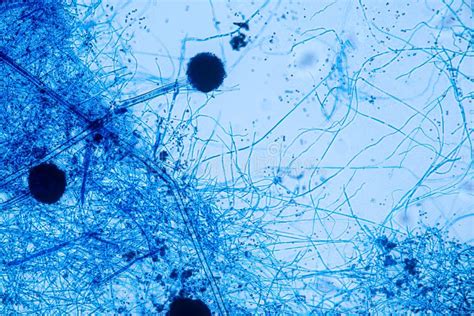 Aspergillus Niger and Aspergillus Oryzae Mold Under Microscope. Stock ...