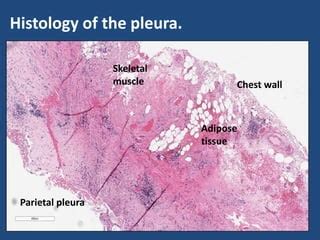 Parietal Pleura Histology