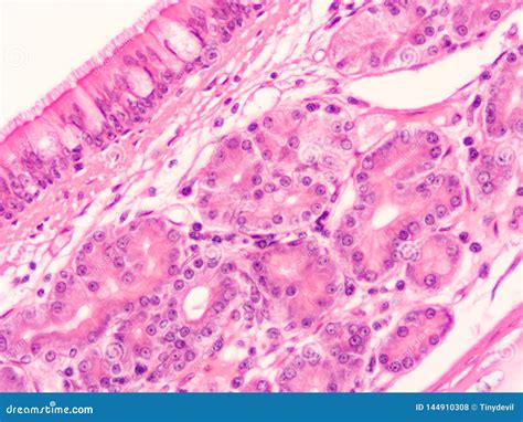 Histology of Trachea Human Tissue Stock Photo - Image of research ...