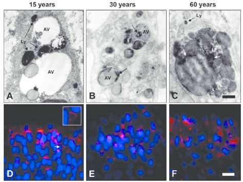 Lysosomal markers in human odontoblasts. (A-C) Acid phosphatase... | Download Scientific Diagram