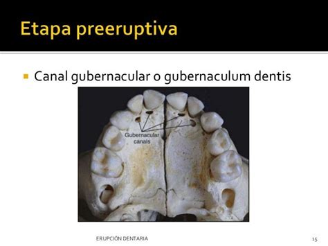 Erupción dentaria