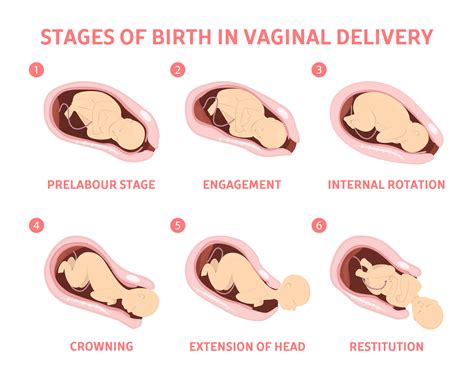 Giving Birth Chart Crowning | ubicaciondepersonas.cdmx.gob.mx