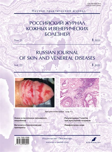 Erythroplasia Of Queyrat