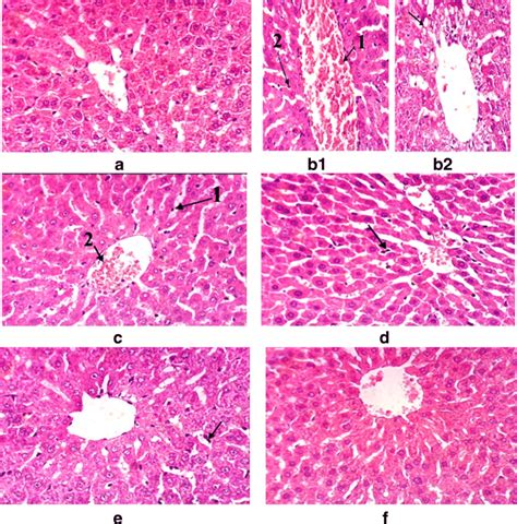 The histological examination of hepatic tissues for the experimental... | Download Scientific ...