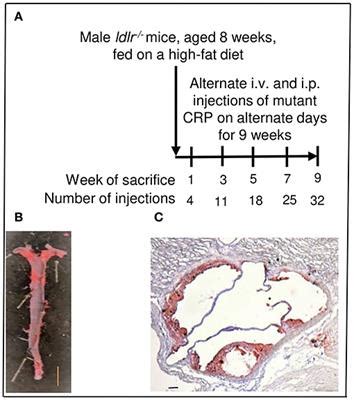 Frontiers | Conformationally Altered C-Reactive Protein Capable of Binding to Atherogenic ...