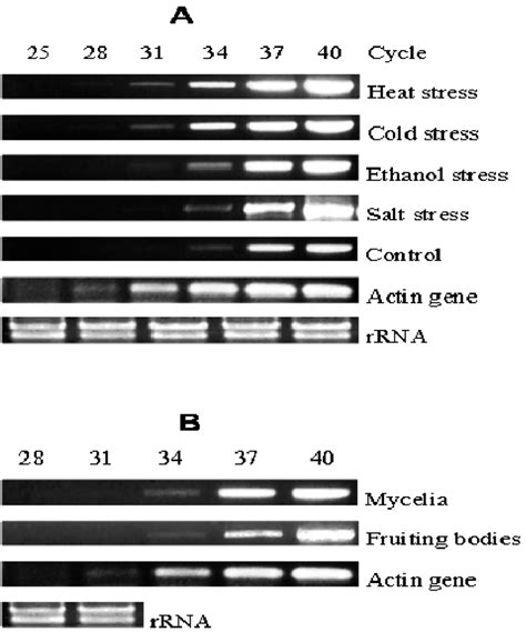 RT-PCR analysis of the L. polychrous GAPDH gene expression upon various... | Download Scientific ...