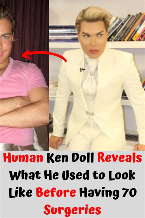 Human Ken Doll Reveals What He Used to Look Like Before Having 70 ...