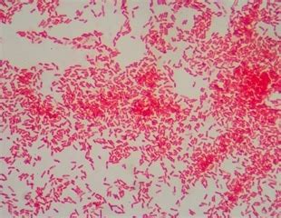 Gram Negative Bacteria