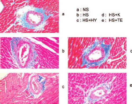 Representative histopathologic photomicrographs of left ventricle at ...