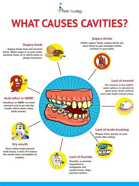 Cavities/ Tooth Decay: Symptoms, Causes, Treatment, and Diagnosis | FindATopDoc