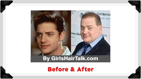 Brendan Fraser Hair Loss, Is He Balding? What Happened?