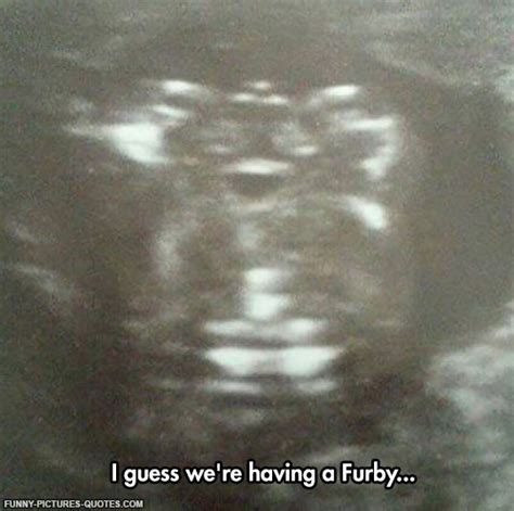 Baby Ultrasound Funny Quotes. QuotesGram