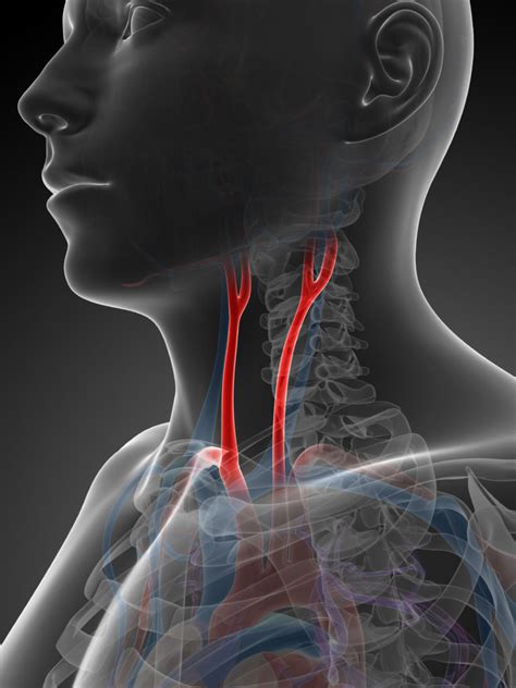 Carotid Endarterectomy | GlobeHealer