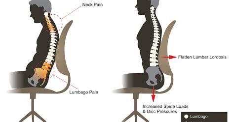 pain relief: Lumbago causes and treatment