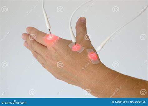 Woman Having EMS or Electrical Muscle Stimulation Stock Photo - Image of hand, therapeutic ...