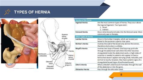 Definition and types of hernia repair