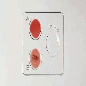 Simulated ABO Blood Typing Kit | Ward's Science