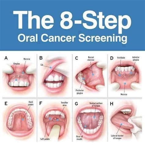 8 Mouth Cancer Symptoms You Constantly Ignore