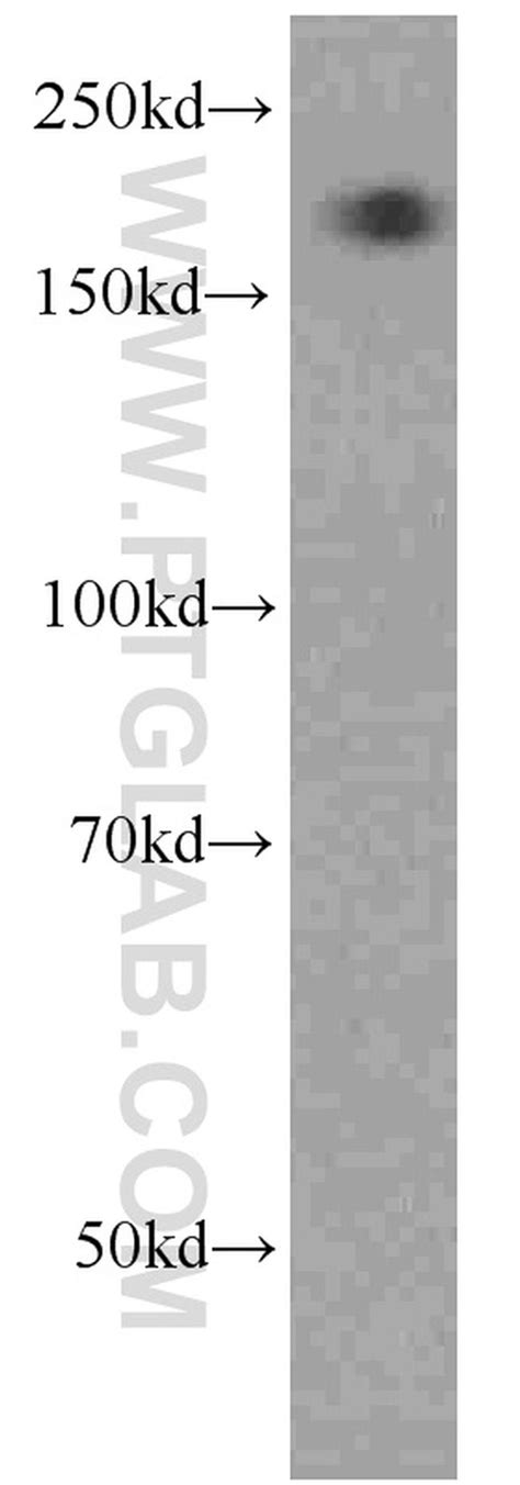 Alpha-2-macroglobulin Monoclonal Antibody (4B11F7) (66126-1-IG)