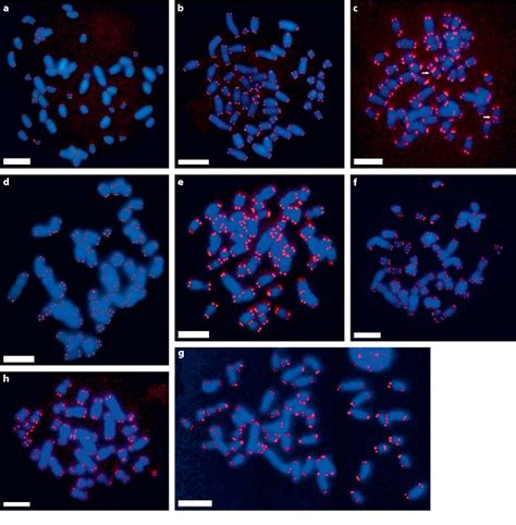 Figure 1 from Chromosomal localization of the telomeric (TTAGGG)n ...