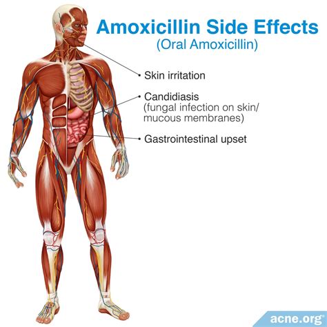 The Side Effects of Antibiotics - Acne.org